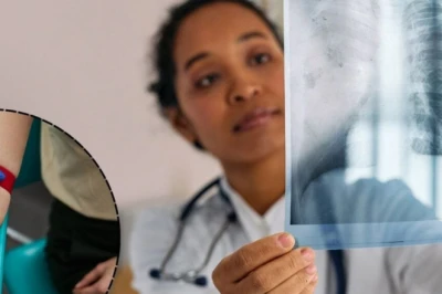 फेफड़ों के कैंसर का पता अब ट्यूमर बनने से 5.6 साल पहले! वैज्ञानिकों के नए ब्लड टेस्ट से बच सकती हैं लाखों जानें
