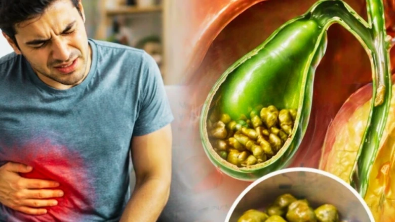 रोज की थाली में छिपे ये फूड्स बनाते हैं पित्त की थैली में पथरी, नौबत आ सकती है सर्जरी तक