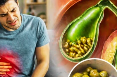 रोज की थाली में छिपे ये फूड्स बनाते हैं पित्त की थैली में पथरी, नौबत आ सकती है सर्जरी तक
