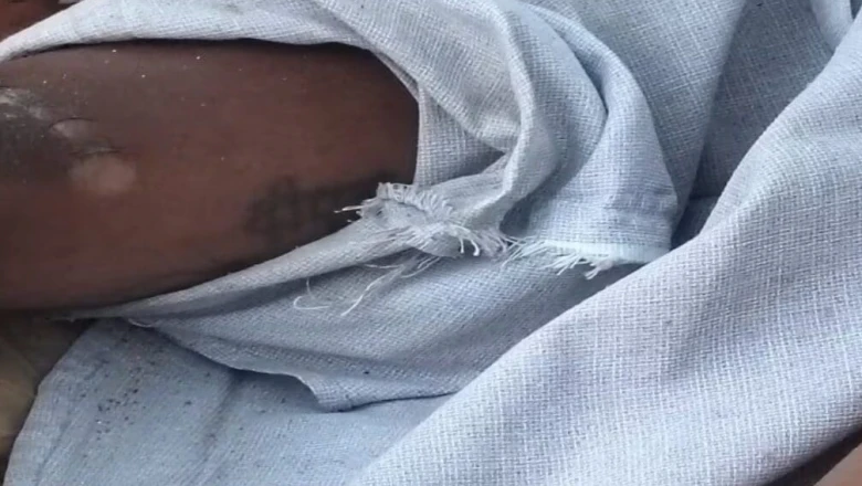 भूतिया नाला के पास सड़क किनारे मिला अज्ञात युवक का शव, सिर पर गहरी चोट के निशान से सनसनी