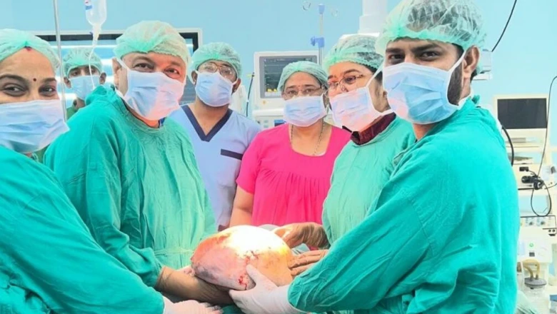 बीकानेर में चिकित्सा का अनूठा कारनामा, पांच घंटे चली पेचीदा सर्जरी में निकाला 20 किलो का ओवेरियन ट्यूमर, बची महिला की जान