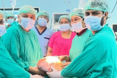 बीकानेर में चिकित्सा का अनूठा कारनामा, पांच घंटे चली पेचीदा सर्जरी में निकाला 20 किलो का ओवेरियन ट्यूमर, बची महिला की जान
