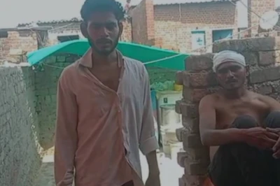 मोबाइल इस्तेमाल से रोका तो भड़की पत्नी, आधी रात भाइयों संग पति के घर धावा, सास का दांत तोड़ा