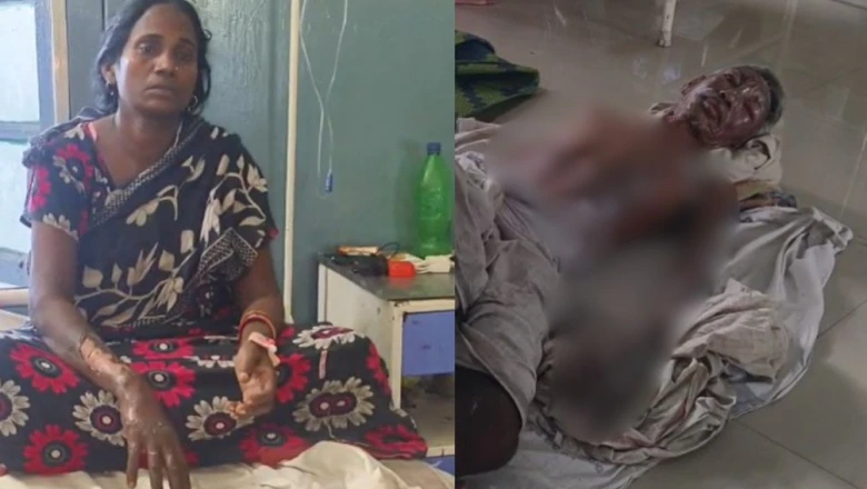 पत्नी को मायके से वापस लाने पहुंचा दामाद, झगड़े के बाद बुजुर्ग सास-ससुर को पेट्रोल डालकर लगाई आग