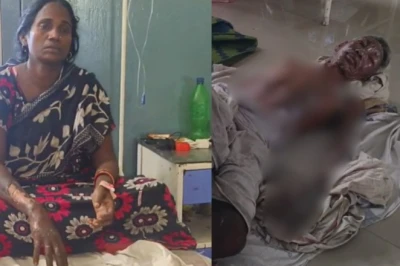 पत्नी को मायके से वापस लाने पहुंचा दामाद, झगड़े के बाद बुजुर्ग सास-ससुर को पेट्रोल डालकर लगाई आग