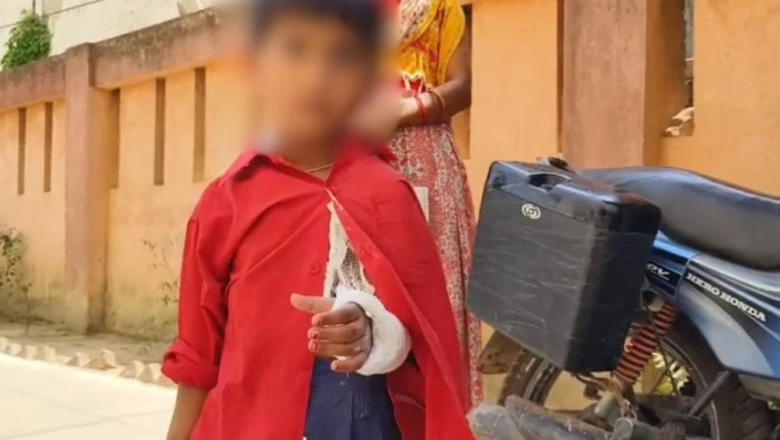 Deoria: Maharshi Devarha Baba Medical College mein doctor ki badi laparwahi, tuta tha dayna hath aur chadha diya baen hath mein plaster