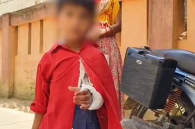 Deoria: Maharshi Devarha Baba Medical College mein doctor ki badi laparwahi, tuta tha dayna hath aur chadha diya baen hath mein plaster