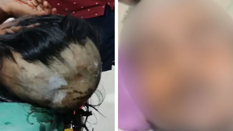 बिहार के समस्तीपुर में रिश्तों की शर्मनाक तस्वीर: चचेरे भाई-बहन को पंचायत ने दी तालिबानी सजा