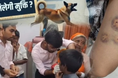 पाली में आवारा कुत्तों का खौफ: 48 घंटे में 17 लोगों को बनाया शिकार, मासूम बच्चे सबसे ज्यादा प्रभावित