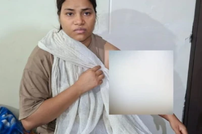 जयपुर: रेशु गुप्ता के इलाज का पूरा खर्च उठाएगी राजस्थान सरकार, लापरवाही बरतने वाले पुलिसकर्मी हुए APO