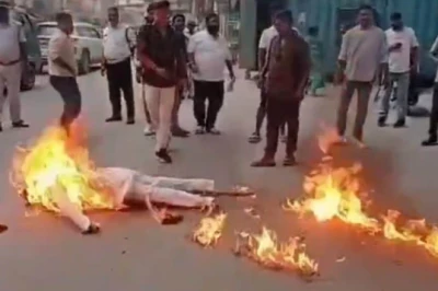 जमशेदपुर में विधायक का पुतला फूंकना पड़ा भारी, आग की चपेट में आने से झुलसे कांग्रेसी कार्यकर्ता