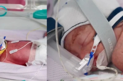 ऑस्ट्रेलिया: महिला ने दिया एक जैसी दिखने वाली 4 बच्चियों को जन्म, डॉक्टरों के लिए भी यह एक चमत्कारिक मामला