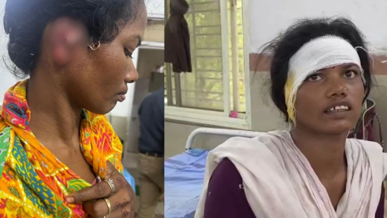 नर्मदापुरम में खूनी पारिवारिक विवाद: ₹1000 के लेनदेन को लेकर देवरानी ने जेठानी का कान काटा