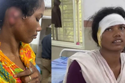 नर्मदापुरम में खूनी पारिवारिक विवाद: ₹1000 के लेनदेन को लेकर देवरानी ने जेठानी का कान काटा