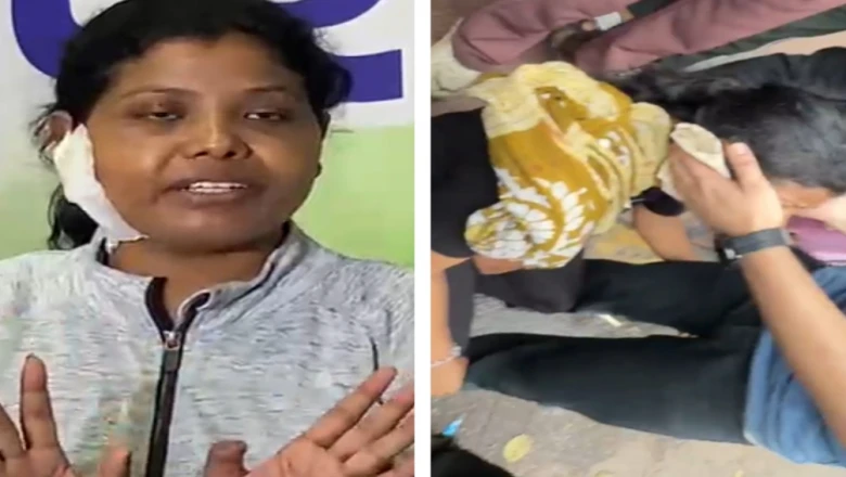 सीजेपी प्रदर्शन हिंसा मामला: दिल्ली पुलिस ने गोली चलने के आरोपों को नकारा, छात्रा ने बयां किया अपना दर्द