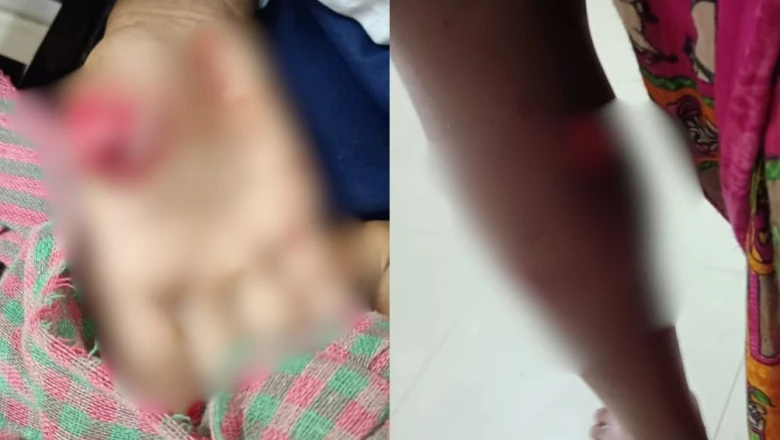 बालेश्वर में खौफनाक वारदात: शौचालय जाते मासूम छात्र पर आवारा कुत्ते ने किया हमला, उंगली काटी
