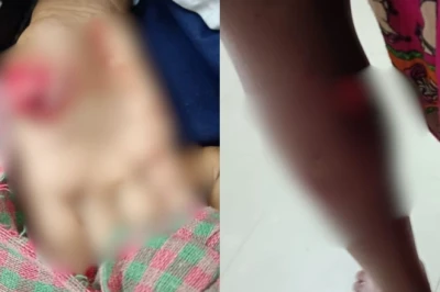 बालेश्वर में खौफनाक वारदात: शौचालय जाते मासूम छात्र पर आवारा कुत्ते ने किया हमला, उंगली काटी